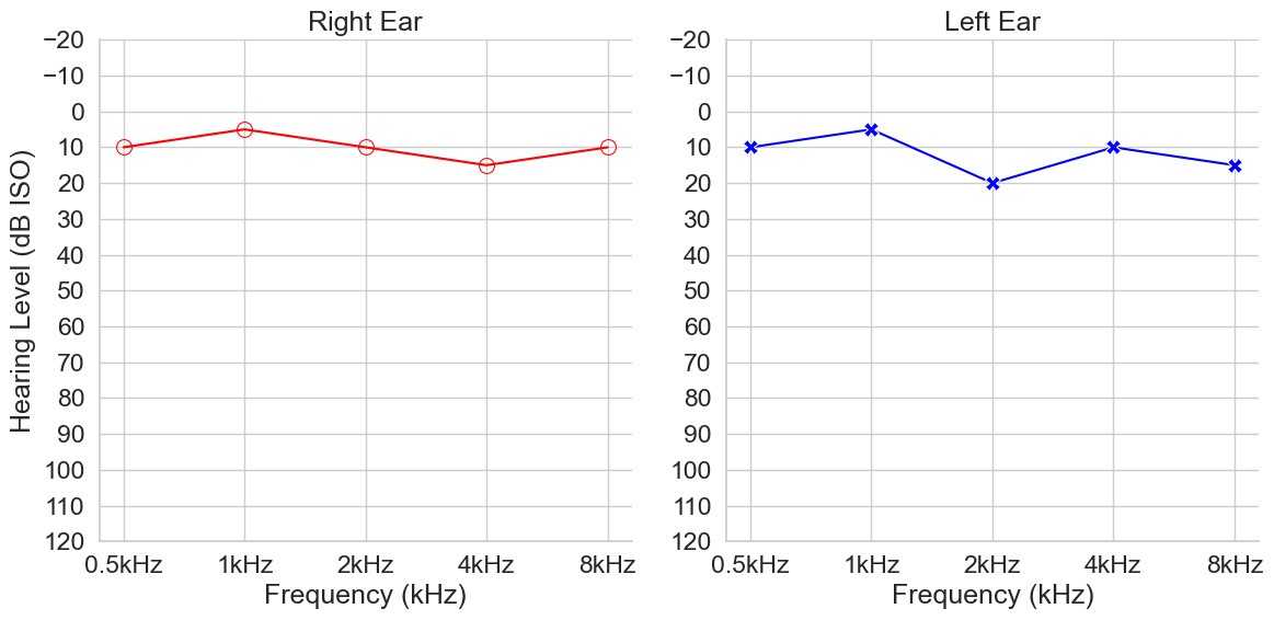 **Fig 1.** Example audiogram curve from The National Health and Nutrition Examination Survey